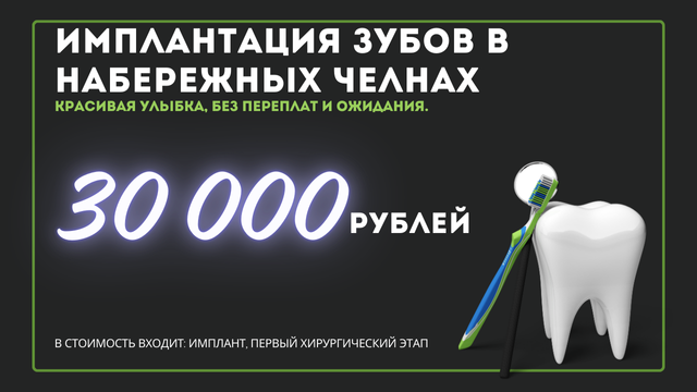 Имплантация зубов от 30 000 рублей